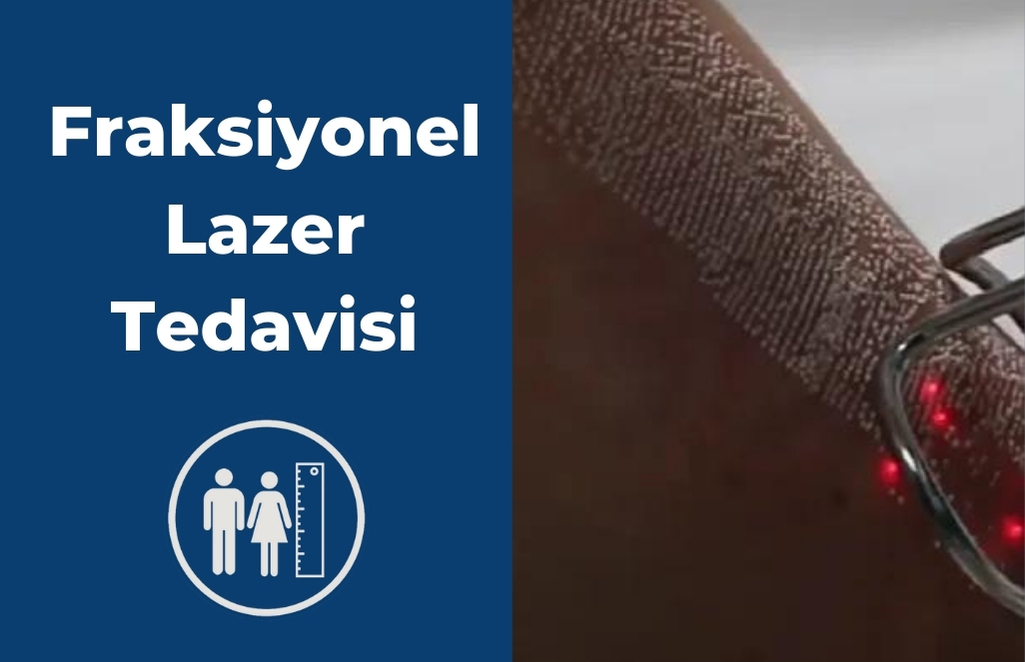 Fraksiyonel Lazer Tedavisi Yara İzi Tedavisi Boy Ameliyatı