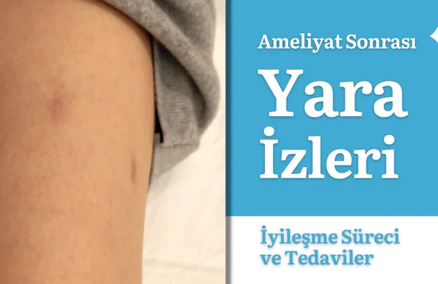 bacak uzatma ameliyatı yara izleri
