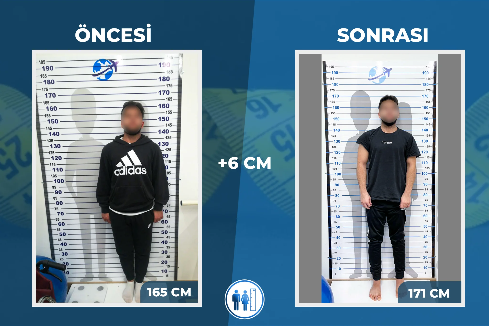 burak öncesi sonrası