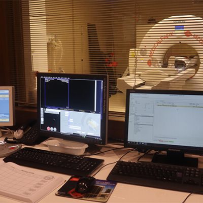 wannabetaller-pre-surgery-x-ray
