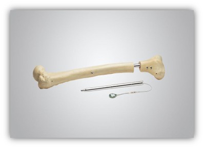 fitbone avantajları