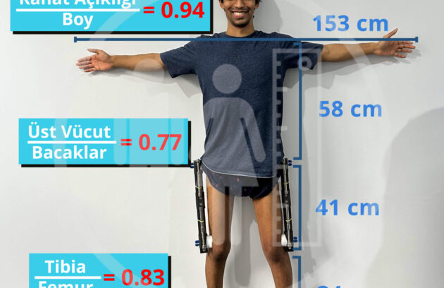 Proportion